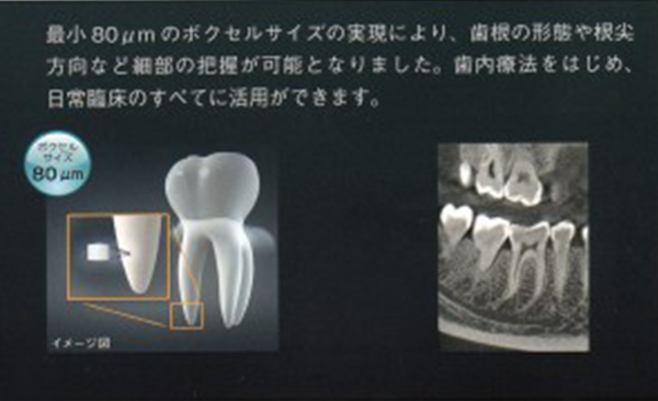 歯科用CTエクセラスマート3Dの特徴、高画質の図①