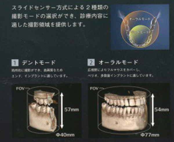 歯科用CTエクセラスマート3Dの特徴、低線量の図②