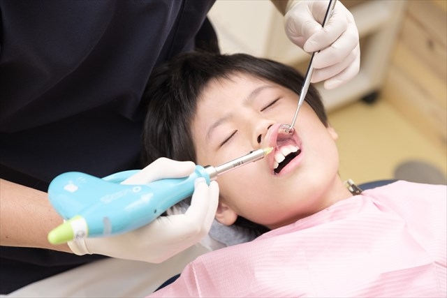当院の虫歯治療のポイント挿入イメージ